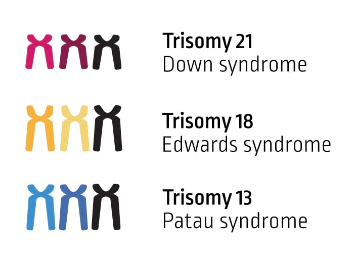 Trisomije